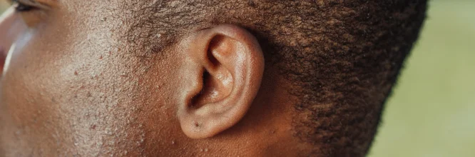Patologías del oído externo